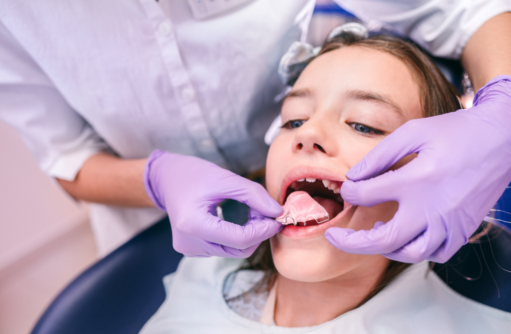 Odontopediatra aplica aparato en la boca de un niño en un tratamiento de ortodoncia interceptiva