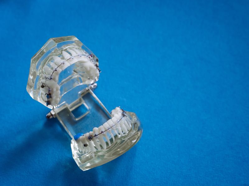 modelo para cirugía maxilofacial