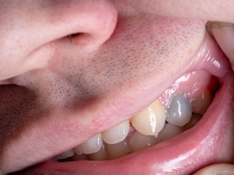 urgencias dentales