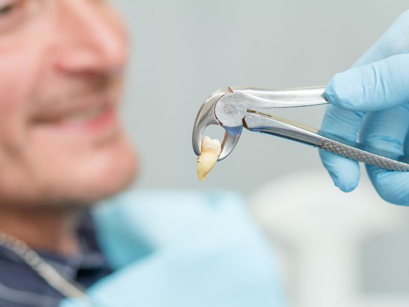 Endodoncia vs. Extracción Dental