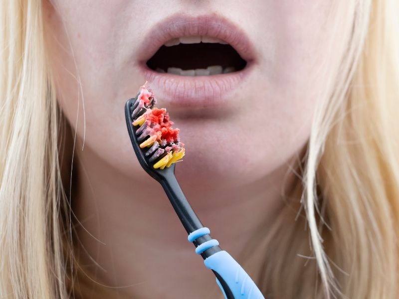 periodoncia