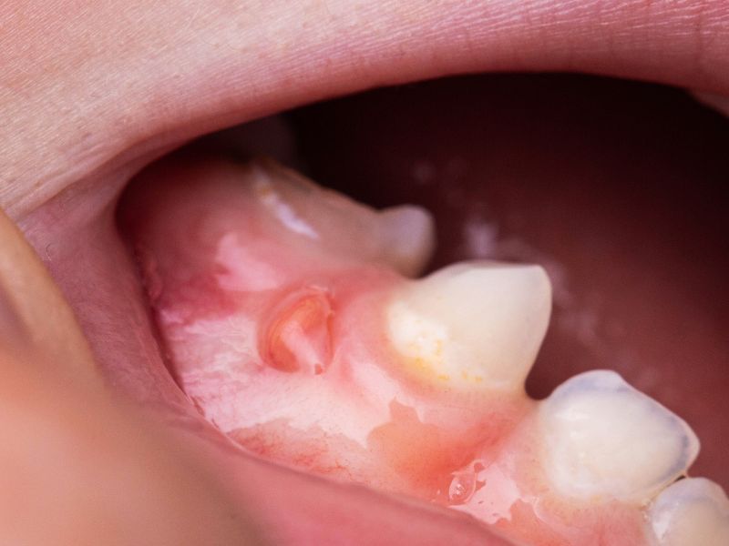 periodoncia