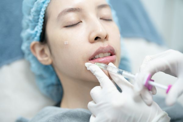 relleno con ácido hialurónico