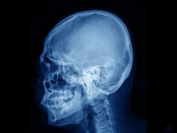 radiología digital