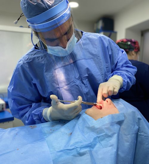 cirugia maxilofacial